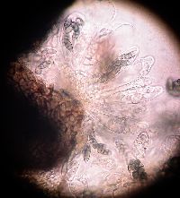 Image of Capronia semi-immersa