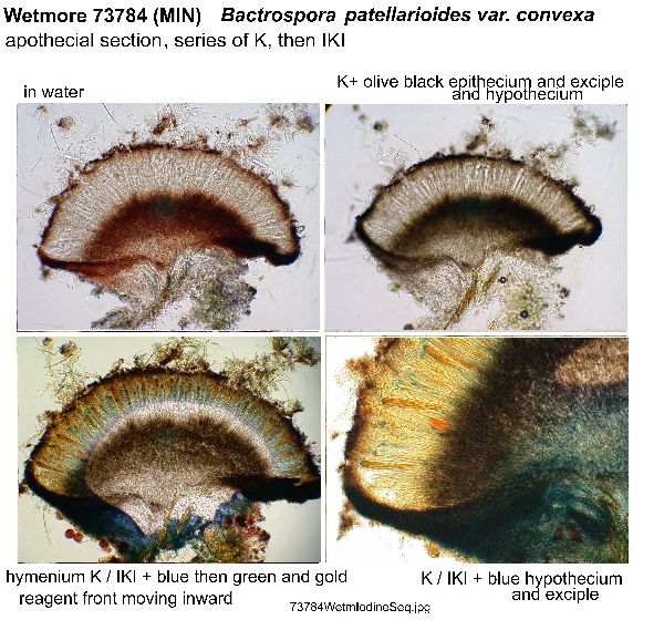 Bactrospora patellarioides image