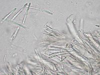 Bactrospora patellarioides image